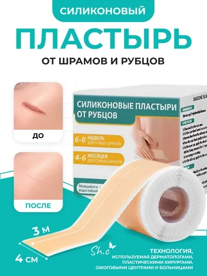 Силиконовый пластырь, лента от шрамов и рубцов, 1.5-3м