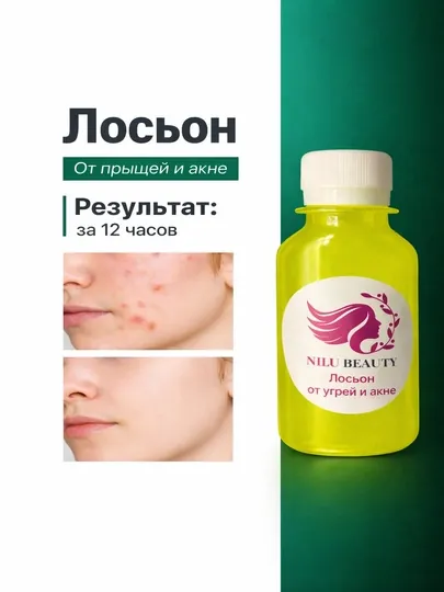 Лосьон против угрей, удаление акне для всех типов кожи лица