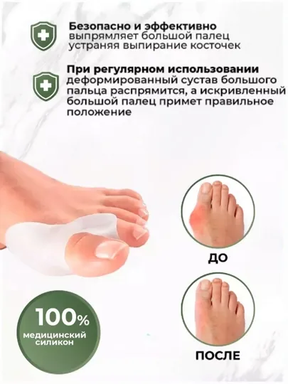 Разделители для пальцев корректор, вальгусный фиксатор